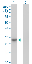 NME6 Antibody - Western blot of NME6 expression in transfected 293T cell line by NME6 monoclonal antibody (M07), clone 2A10.