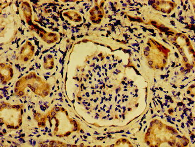NME6 Antibody - Immunohistochemistry of paraffin-embedded human kidney tissue using NME6 Antibody at dilution of 1:100