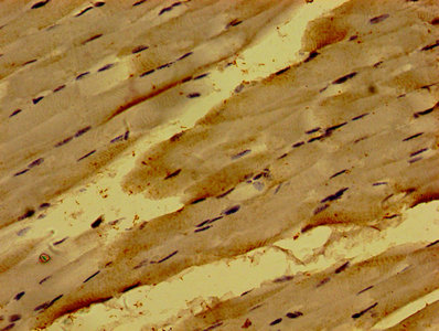 NME6 Antibody - Immunohistochemistry of paraffin-embedded human skeletal muscle tissue using NME6 Antibody at dilution of 1:100