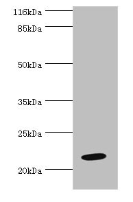 NME6 Antibody - Western blot All lanes: NME6 antibody at 2µg/ml + Hela cells Secondary Goat polyclonal to rabbit IgG at 1/10000 dilution Predicted band size: 22, 14, 19 kDa Observed band size: 22 kDa