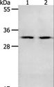 NME6 Antibody - Western blot analysis of Mouse spleen and intestinum crassum tissue, using NME6 Polyclonal Antibody at dilution of 1:400.