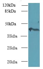 NME7 Antibody - Western blot. All lanes: NME7 antibody at 12 ug/ml+ Mouse liver tissue Goat polyclonal to rabbit at 1:10000 dilution. Predicted band size: 42 kDa. Observed band size: 42 kDa.