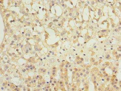 NME7 Antibody - Immunohistochemistry of paraffin-embedded human adrenal gland tissue using antibody at dilution of 1:100.