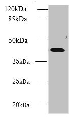 NME7 Antibody - Western blot All lanes: NME7 antibody at 12µg/ml + Mouse liver tissue Secondary Goat polyclonal to rabbit IgG at 1/10000 dilution Predicted band size: 43, 39 kDa Observed band size: 43 kDa
