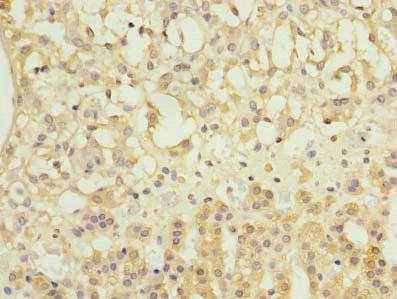 NME7 Antibody - Immunohistochemistry of paraffin-embedded human adrenal gland tissue using NME7 Antibody at dilution of 1:100