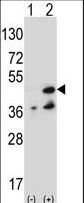 NME7 Antibody - Western blot of NME7 (arrow) using rabbit polyclonal NME7 Antibody (V40). 293 cell lysates (2 ug/lane) either nontransfected (Lane 1) or transiently transfected (Lane 2) with the NME7 gene.