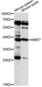 NME7 Antibody - Western blot analysis of extracts of various cell lines, using NME7 antibody at 1:1000 dilution. The secondary antibody used was an HRP Goat Anti-Rabbit IgG (H+L) at 1:10000 dilution. Lysates were loaded 25ug per lane and 3% nonfat dry milk in TBST was used for blocking. An ECL Kit was used for detection and the exposure time was 10s.