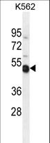 NME9 / TXNDC6 Antibody - TXNDC6 Antibody western blot of K562 cell line lysates (35 ug/lane). The TXNDC6 antibody detected the TXNDC6 protein (arrow).