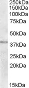 NME9 / TXNDC6 Antibody - Antibody (2 ug/ml) staining of Human Uterus lysate (35 ug protein in RIPA buffer). Primary incubation was 1 hour. Detected by chemiluminescence