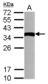 NME9 / TXNDC6 Antibody - Sample (30 ug of whole cell lysate) A: NT2D1 12% SDS PAGE TXNDC6 antibody diluted at 1:1000