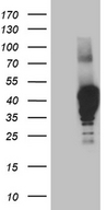 NMI Antibody - HEK293T cells were transfected with the pCMV6-ENTRY control. (Left lane) or pCMV6-ENTRY NMI. (Right lane) cDNA for 48 hrs and lysed