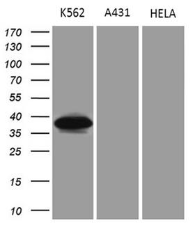 NMI Antibody - Western blot analysis of extracts. (35ug) from 3 different cell lines by using anti-NMI monoclonal antibody. (1:500)