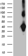 NMI Antibody - HEK293T cells were transfected with the pCMV6-ENTRY control. (Left lane) or pCMV6-ENTRY NMI. (Right lane) cDNA for 48 hrs and lysed. Equivalent amounts of cell lysates. (5 ug per lane) were separated by SDS-PAGE and immunoblotted with anti-NMI. (1:2000)