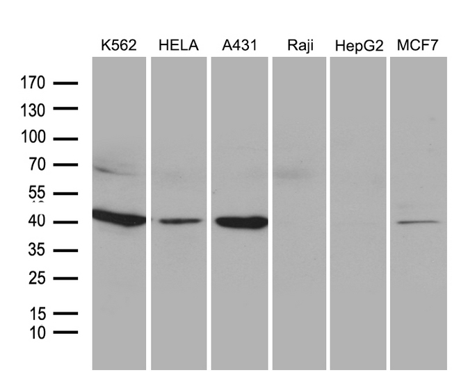 NMI Antibody - Western blot analysis of extracts. (35ug) from 6 different cell lines by using anti-NMI monoclonal antibody. (1:500)