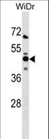 NMI Antibody - NMI Antibody western blot of WiDr cell line lysates (35 ug/lane). The NMI antibody detected the NMI protein (arrow).