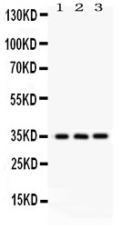 NMI Antibody - NMI antibody Western blot. All lanes: Anti NMI at 0.5 ug/ml. Lane 1: Human Placenta Tissue Lysate at 50 ug. Lane 2: A549 Whole Cell Lysate at 40 ug. Lane 3: HELA Whole Cell Lysate at 40 ug. Predicted band size: 35 kD. Observed band size: 35 kD.