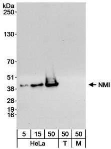 NMI Antibody - Detection of Human NMI by Western Blot. Samples: Whole cell lysate from HeLa (5, 15 and 50 ug), 293T (T; 50 ug) and NIH3T3 (M; 50 ug) cells. Antibody: Affinity purified rabbit anti-NMI antibody used at 0.04 ug/ml for WB. Detection: Chemiluminescence with an exposure time of 30 seconds.