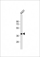 NMI Antibody - Anti-NMI Antibody at 1:2000 dilution + A431 whole cell lysate Lysates/proteins at 20 ug per lane. Secondary Goat Anti-mouse IgG, (H+L), Peroxidase conjugated at 1:10000 dilution. Predicted band size: 35 kDa. Blocking/Dilution buffer: 5% NFDM/TBST.