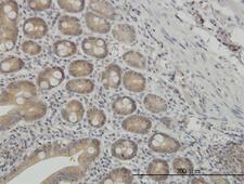 NMI Antibody - Immunoperoxidase of monoclonal antibody to NMI on formalin-fixed paraffin-embedded human small Intestine. [antibody concentration 3 ug/ml]
