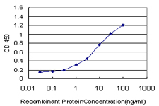 NMI Antibody - Detection limit for recombinant GST tagged NMI is approximately 0.3 ng/ml as a capture antibody.