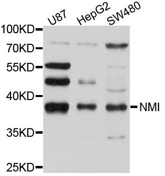 NMI Antibody - Western blot analysis of extracts of various cell lines, using NMI antibody at 1:1000 dilution. The secondary antibody used was an HRP Goat Anti-Rabbit IgG (H+L) at 1:10000 dilution. Lysates were loaded 25ug per lane and 3% nonfat dry milk in TBST was used for blocking. An ECL Kit was used for detection and the exposure time was 90s.