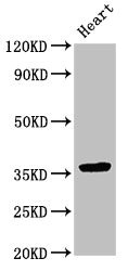 NMI Antibody - Western Blot Positive WB detected in:Rat heart tissue All Lanes:NMI antibody at 3.5µg/ml Secondary Goat polyclonal to rabbit IgG at 1/50000 dilution Predicted band size: 36 KDa Observed band size: 36 KDa