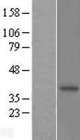 NMI Protein - Western validation with an anti-DDK antibody * L: Control HEK293 lysate R: Over-expression lysate