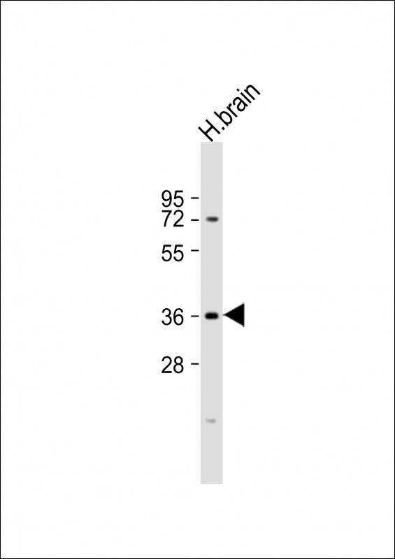 NMNAT1 / NMNAT Antibody - Anti-NMNAT1 Antibody (C-Term) at 1:1000 dilution + human brain lysate Lysates/proteins at 20 ug per lane. Secondary Goat Anti-Rabbit IgG, (H+L), Peroxidase conjugated at 1:10000 dilution. Predicted band size: 32 kDa. Blocking/Dilution buffer: 5% NFDM/TBST.