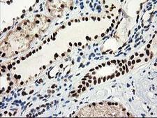 NMNAT1 / NMNAT Antibody - IHC of paraffin-embedded Human Kidney tissue using anti-NMNAT1 mouse monoclonal antibody. (Heat-induced epitope retrieval by 10mM citric buffer, pH6.0, 100C for 10min).