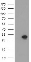 NMNAT1 / NMNAT Antibody - HEK293T cells were transfected with the pCMV6-ENTRY control (Left lane) or pCMV6-ENTRY NMNAT1 (Right lane) cDNA for 48 hrs and lysed. Equivalent amounts of cell lysates (5 ug per lane) were separated by SDS-PAGE and immunoblotted with anti-NMNAT1.