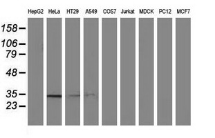 NMNAT1 / NMNAT Antibody - Western blot of extracts (35ug) from 9 different cell lines by using anti-NMNAT1 monoclonal antibody.