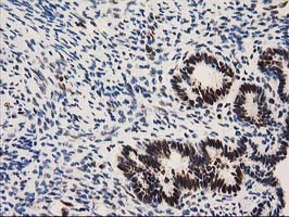 NMNAT1 / NMNAT Antibody - IHC of paraffin-embedded Human endometrium tissue using anti-NMNAT1 mouse monoclonal antibody. (Heat-induced epitope retrieval by 10mM citric buffer, pH6.0, 100C for 10min).