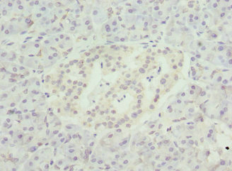 NMNAT1 / NMNAT Antibody - Immunohistochemistry of paraffin-embedded human pancreatic tissue at dilution 1:100