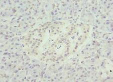 NMNAT1 / NMNAT Antibody - Immunohistochemistry of paraffin-embedded human pancreatic tissue at dilution 1:100
