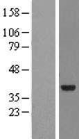 NMNAT2 Protein - Western validation with an anti-DDK antibody * L: Control HEK293 lysate R: Over-expression lysate