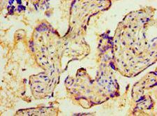 NMNAT3 Antibody - Immunohistochemistry of paraffin-embedded human placenta tissue using antibody at 1:100 dilution.  This image was taken for the unconjugated form of this product. Other forms have not been tested.