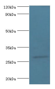NMNAT3 Antibody - Western blot. All lanes: Nicotinamide mononucleotide adenylyltransferase 3 antibody at 2 ug/ml+mouse brain tissue. Secondary antibody: Goat polyclonal to rabbit at 1:10000 dilution. Predicted band size: 28 kDa. Observed band size: 28 kDa.  This image was taken for the unconjugated form of this product. Other forms have not been tested.