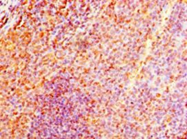 NMNAT3 Antibody - Immunohistochemistry of paraffin-embedded human tonsil tissue using antibody at 1:100 dilution.  This image was taken for the unconjugated form of this product. Other forms have not been tested.