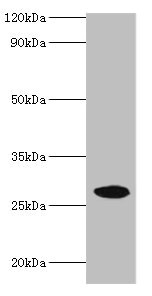 NMNAT3 Antibody - Western blot All lanes: Nicotinamide mononucleotide adenylyltransferase 3 antibody at 2µg/ml + Mouse brain tissue Secondary Goat polyclonal to rabbit IgG at 1/10000 dilution Predicted band size: 29, 25, 19 kDa Observed band size: 29 kDa