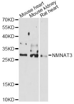 NMNAT3 Antibody - Western blot analysis of extracts of various cell lines, using NMNAT3 antibody at 1:3000 dilution. The secondary antibody used was an HRP Goat Anti-Rabbit IgG (H+L) at 1:10000 dilution. Lysates were loaded 25ug per lane and 3% nonfat dry milk in TBST was used for blocking. An ECL Kit was used for detection and the exposure time was 90s.