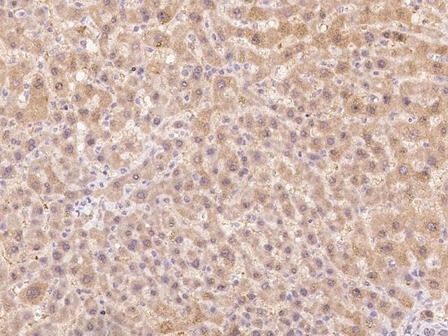 NMNAT3 Antibody - Immunochemical staining of human NMNAT3 in human liver with rabbit polyclonal antibody at 1:100 dilution, formalin-fixed paraffin embedded sections.