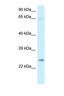 NMNAT3 Antibody - NMNAT3 antibody Western blot of Fetal Brain lysate. Antibody concentration 1 ug/ml.  This image was taken for the unconjugated form of this product. Other forms have not been tested.