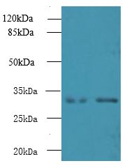 NMRAL1 / HSCARG Antibody - Western blot. All lanes: NMRAL1 antibody at 6 ug/ml. Lane 1: Jurkat whole cell lysate. Lane 2: HeLa whole cell lysate. Secondary antibody: Goat polyclonal to Rabbit IgG at 1:10000 dilution. Predicted band size: 33 kDa. Observed band size: 33 kDa.