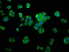 NMRAL1 / HSCARG Antibody - Immunofluorescence staining of PC-3 cells with NMRAL1 Antibody at 1:200, counter-stained with DAPI. The cells were fixed in 4% formaldehyde, permeabilized using 0.2% Triton X-100 and blocked in 10% normal Goat Serum. The cells were then incubated with the antibody overnight at 4°C. The secondary antibody was Alexa Fluor 488-congugated AffiniPure Goat Anti-Rabbit IgG(H+L).