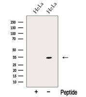 NMRAL1 / HSCARG Antibody - Western blot analysis of extracts of HeLa cells using NMRAL1 antibody. The lane on the left was treated with blocking peptide.