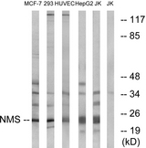 NMS Antibody - Western blot analysis of lysates from Jurkat, HepG2, HUVEC, 293, and MCF-7 cells, using NMS Antibody. The lane on the right is blocked with the synthesized peptide.