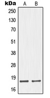NMS Antibody - Western blot analysis of Neuromedin S expression in HepG2 (A); MCF7 (B) whole cell lysates.