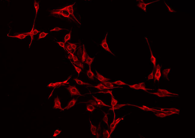 NMS Antibody - Staining HeLa cells by IF/ICC. The samples were fixed with PFA and permeabilized in 0.1% Triton X-100, then blocked in 10% serum for 45 min at 25°C. The primary antibody was diluted at 1:200 and incubated with the sample for 1 hour at 37°C. An Alexa Fluor 594 conjugated goat anti-rabbit IgG (H+L) Ab, diluted at 1/600, was used as the secondary antibody.