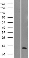 NMS Protein - Western validation with an anti-DDK antibody * L: Control HEK293 lysate R: Over-expression lysate