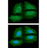 NMT1 Antibody - ICC/IF analysis of NMT1 in HeLa cells line, stained with DAPI (Blue) for nucleus staining and monoclonal anti-human NMT1 antibody (1:100) with goat anti-mouse IgG-Alexa fluor 488 conjugate (Green).